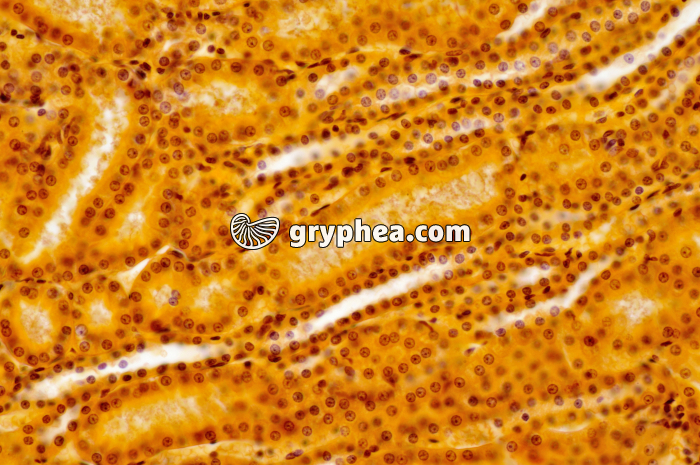 Tubules Rein x100 - gryphea.com
